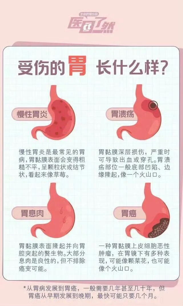 52岁女医生从确诊到离世仅2个月，每年正常体检但却忽视了这项…