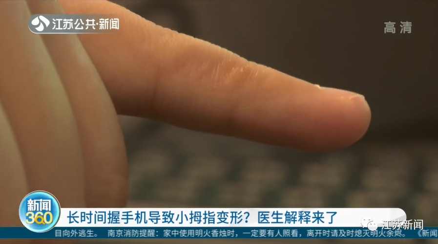 后果严重，赶紧改掉！别再让小拇指“硬扛”手机了