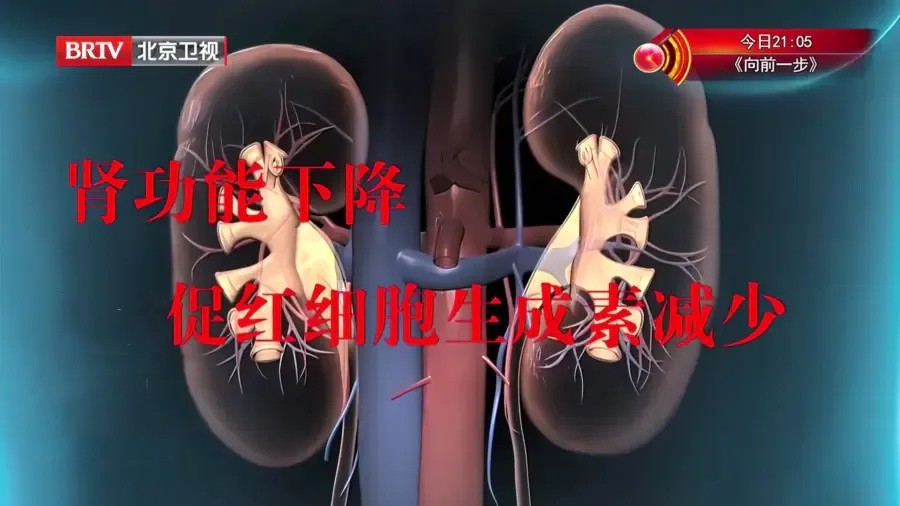 这个不起眼的小事，正毁掉你的肾，3大肾“求救”信号，很多人却忽视了