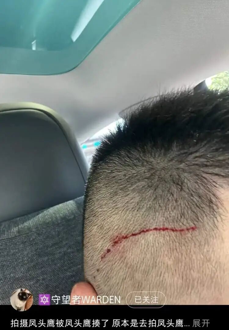上海有人被鸟“揍”了，头部血痕惊心！工作人员提醒：此为猛禽，注意安全