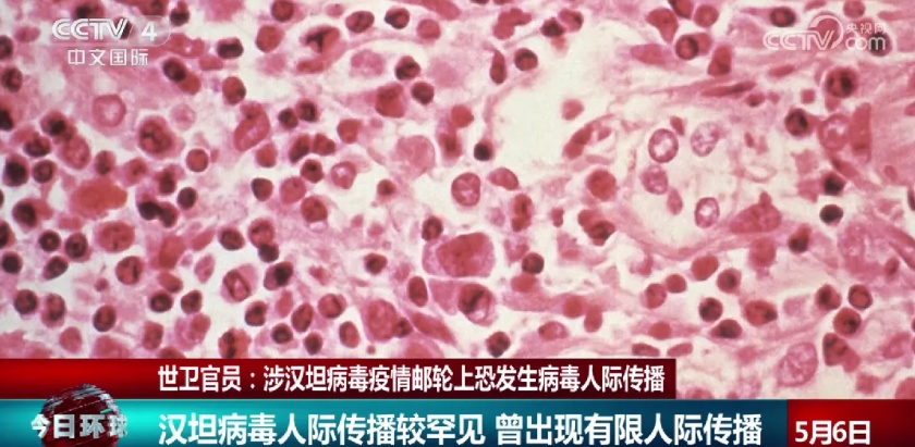 汉坦病毒人传人？我们要注意啥？看疾控专家来解读
