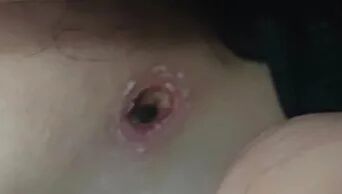 进入活跃期，北京已有多人被叮咬！严重者从有症状到死亡仅9天…