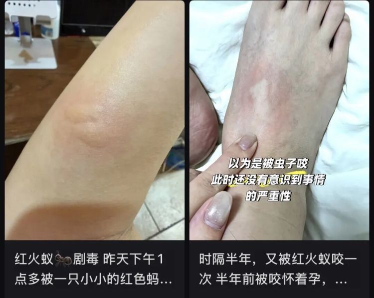 外出看见这种小土包，千万别踩，有人曾因此丧命……
