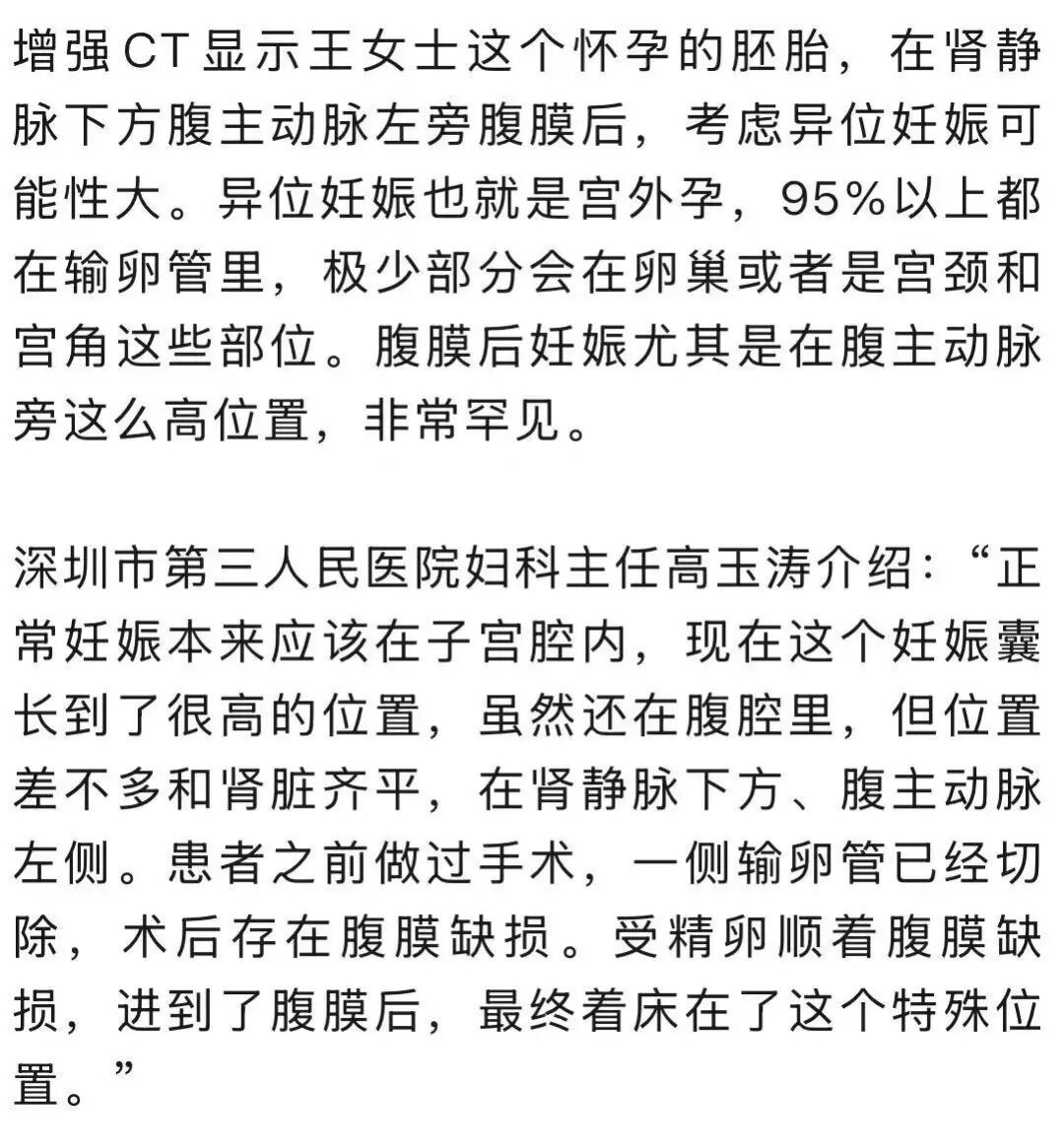 女子怀孕照B超却怎么也找不到“宝宝”!医生检查后惊了:非常罕见… 女子怀孕照B超却怎么也找不到“宝宝”!医生检查后惊了:非常罕见…