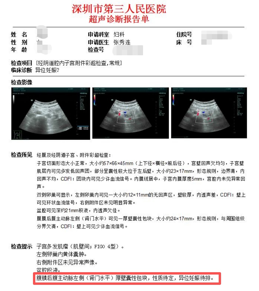 女子怀孕照B超却怎么也找不到“宝宝”!医生检查后惊了:非常罕见… 女子怀孕照B超却怎么也找不到“宝宝”!医生检查后惊了:非常罕见…