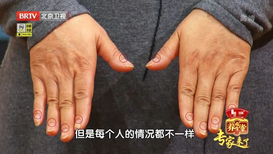 指甲月牙越多，阳气越旺，血脉循环越好？教你两招，扶阳又延寿