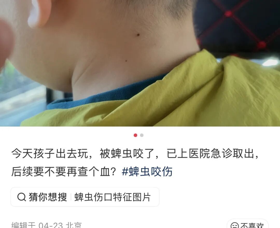 警惕！北京已有多人被叮咬，严重可致死