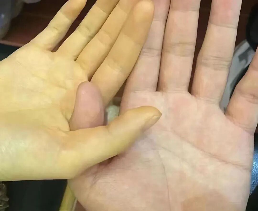 网友热议！“菜市场不准剥蚕豆”引热议！是怕引发蚕豆病？农贸市场辟谣→