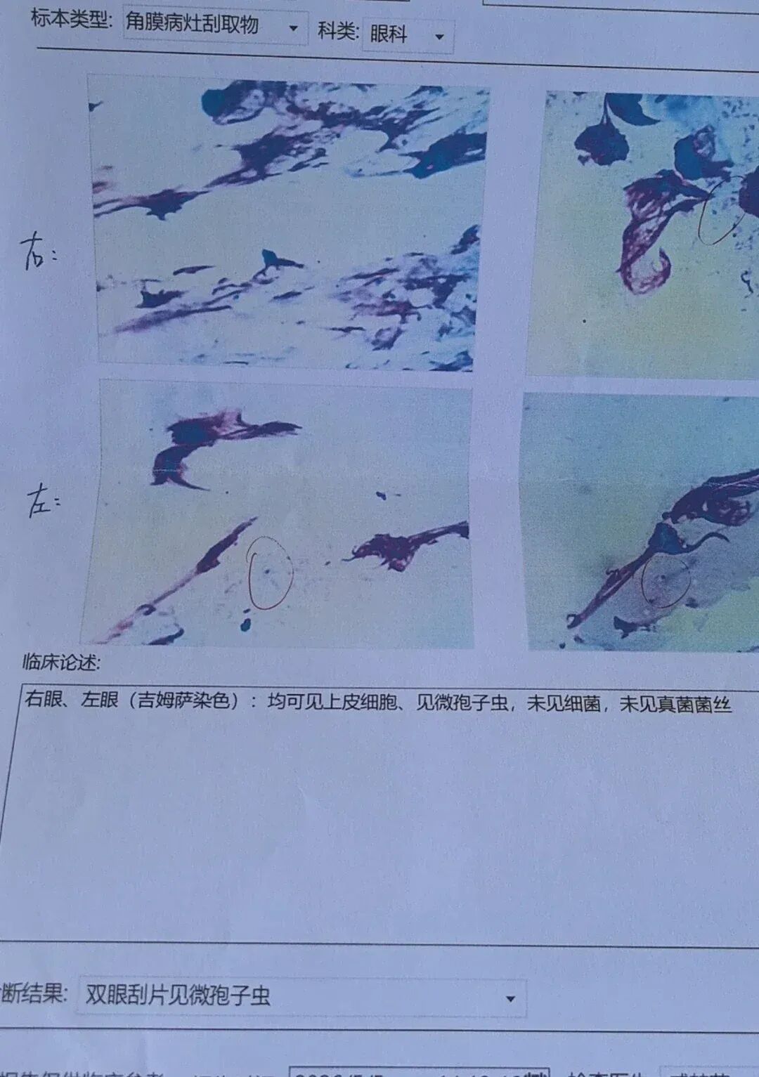 女子养鹦鹉20天感染寄生虫，辗转3家医院才确诊！专家：定期驱虫，避免过度亲密接触