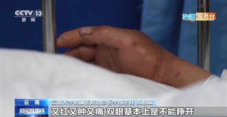 尝鲜需谨慎 这些有毒野生菌千万别乱采乱吃