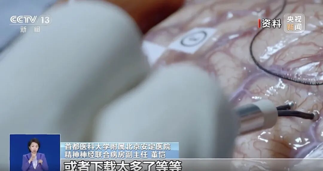 突然成了"网红病"?网友"自我确诊"这个部位受损,靠谱吗? 突然成了"网红病"?网友"自我确诊"这个部位受损,靠谱吗?