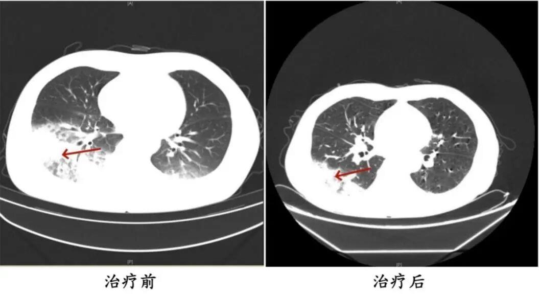 高温季即将开启 家里开空调前别忘做好这一步