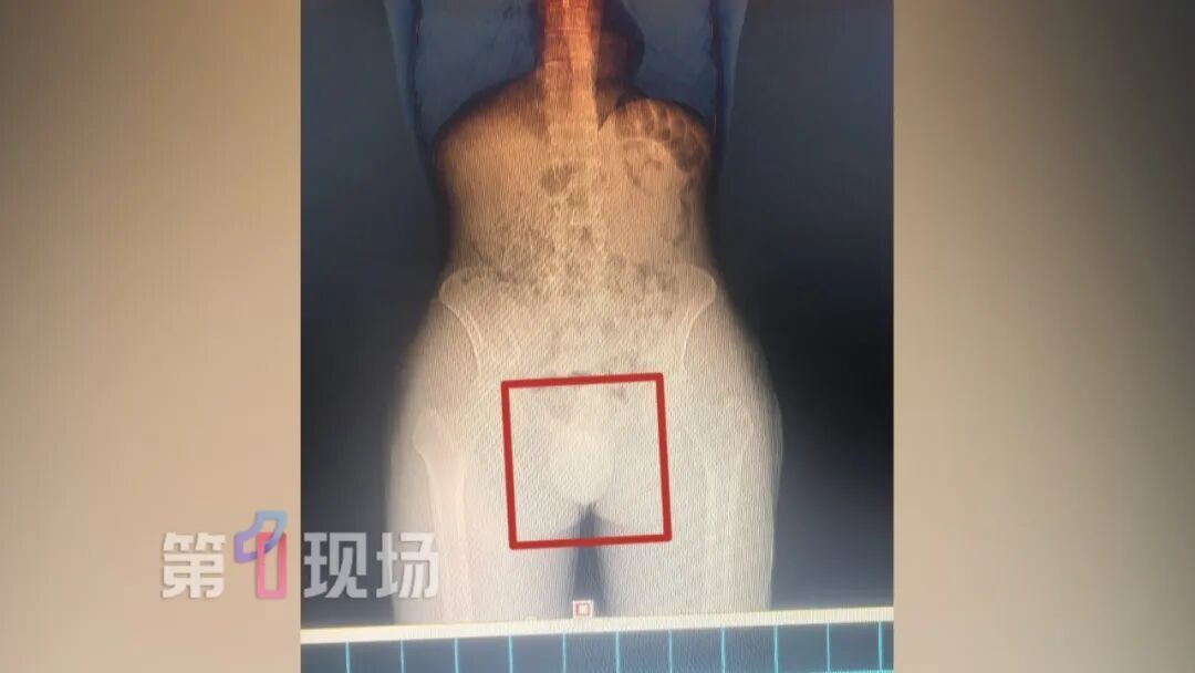 奇葩藏毒太荒唐！男子内裤夹带冰毒被查获