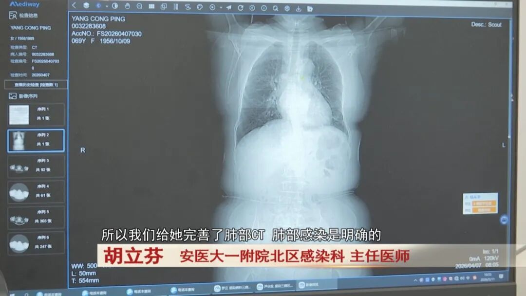 69岁老人高烧不退，竟是家中“萌宠”惹祸！