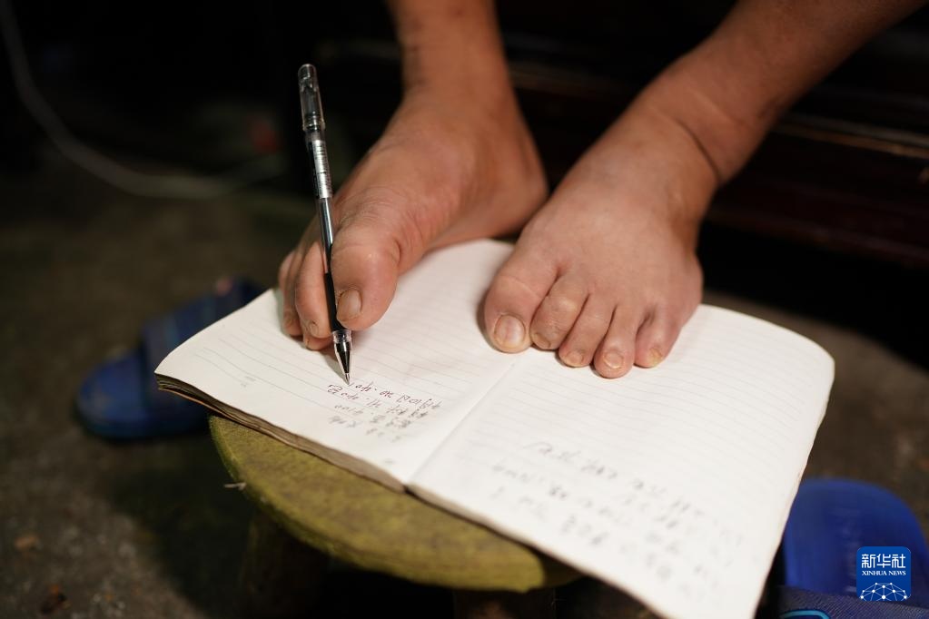 没有胳膊，一样打拼出精彩人生