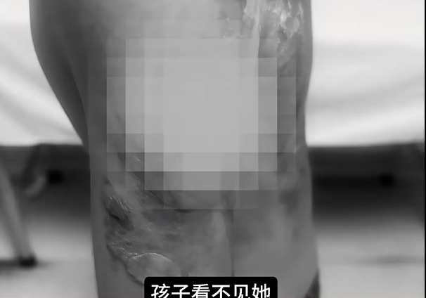 看着都疼!男童在海底捞奔跑撞上高温红油锅 看着都疼!男童在海底捞奔跑撞上高温红油锅
