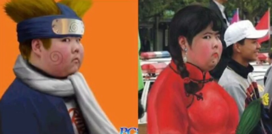 曾火遍全网的“网红小胖”，如今样貌大变！每周血透3次……仍在寻求机会