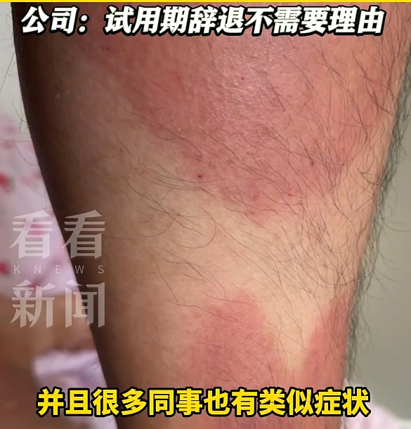 一中国男子称在澳洲肉厂举报安全隐患被当场辞退