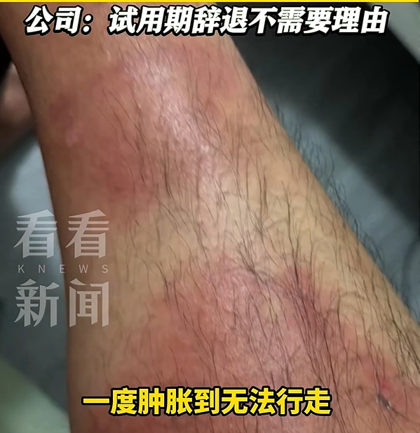 一中国男子称在澳洲肉厂举报安全隐患被当场辞退