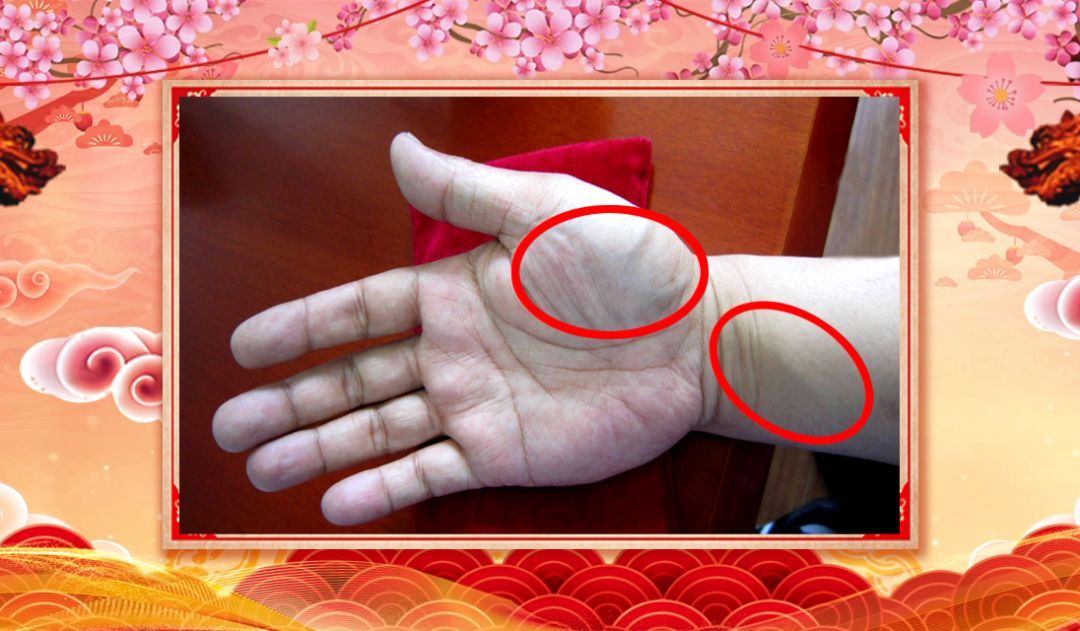 手上有这个表现，多半是心脏不好，2个实用小方，帮你降脂、祛火、护血管