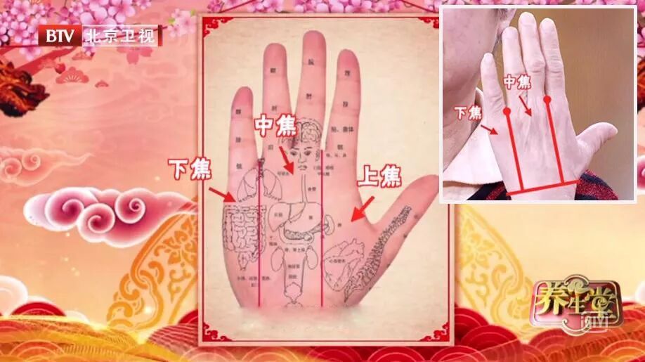 手上有这个表现，多半是心脏不好，2个实用小方，帮你降脂、祛火、护血管