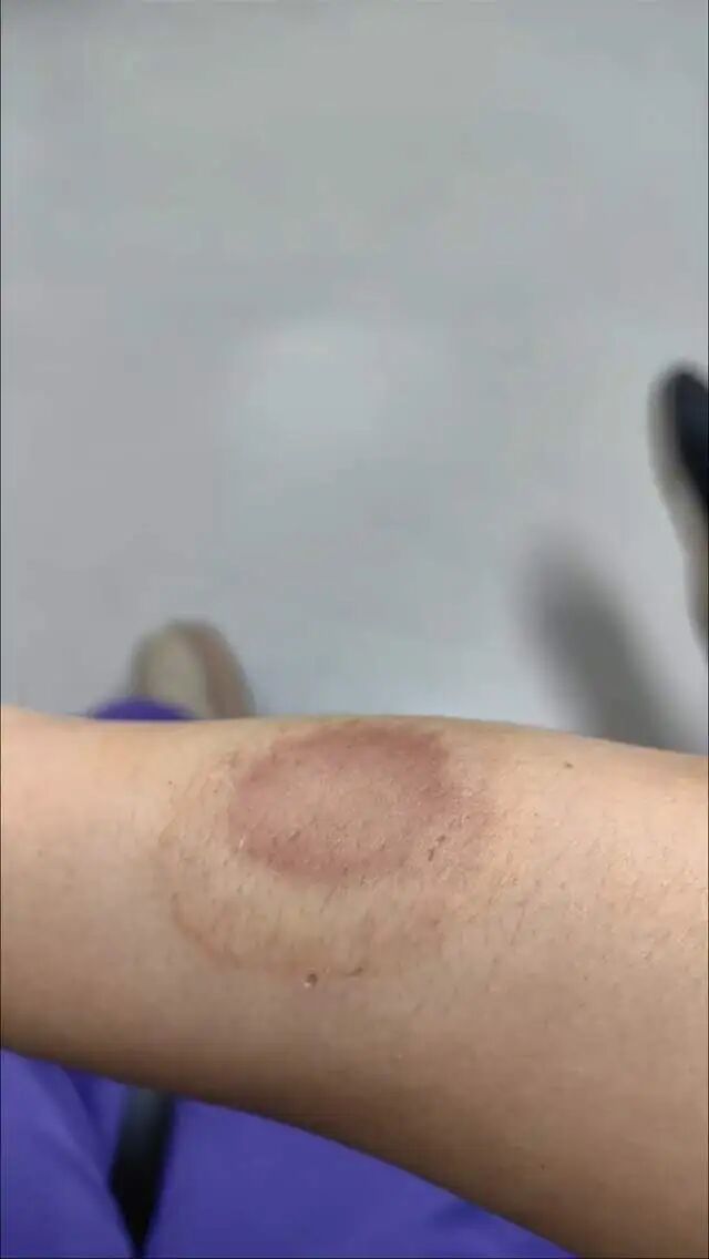 “被打醒后一脸懵”!女子贴条提醒邻居“别在我门口放垃圾”,被对方凌晨谎称“捉奸”撬锁入室进行殴打 “被打醒后一脸懵”!女子贴条提醒邻居“别在我门口放垃圾”,被对方凌晨谎称“捉奸”撬锁入室进行殴打