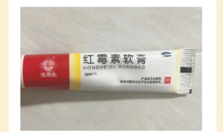 红霉素软膏绝不能随便用！赶紧转给家人