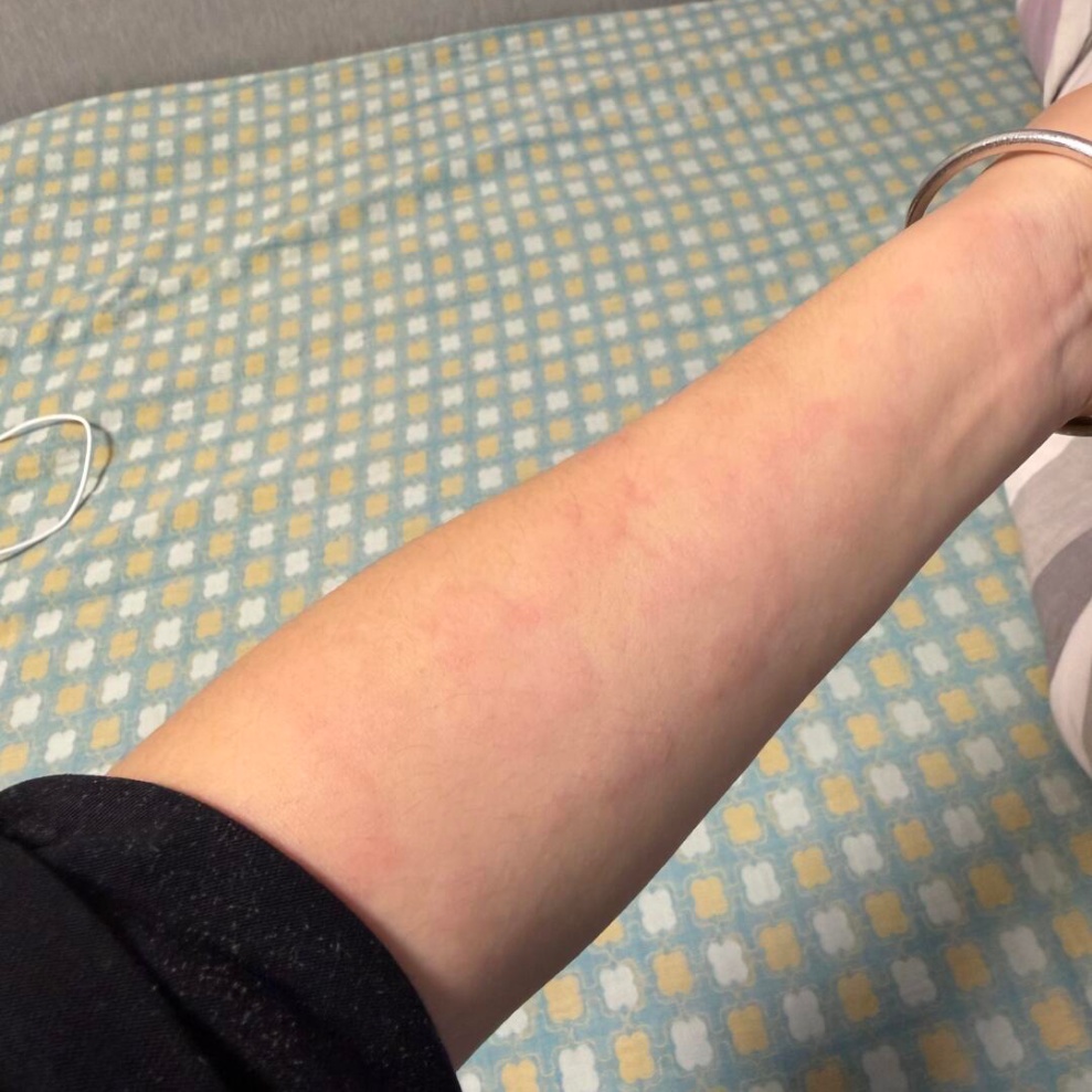 提醒所有人！过敏反复总不好？根源全在这几类东西里！