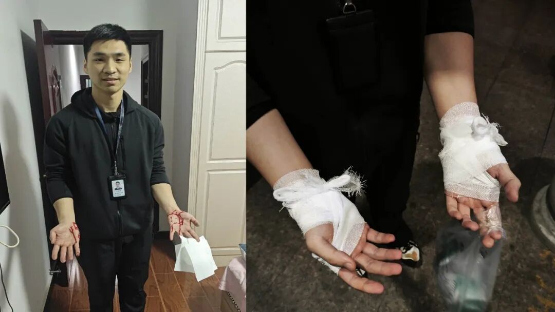 “幸好没扎脸上,不然婚都结不了了……” “幸好没扎脸上,不然婚都结不了了……”