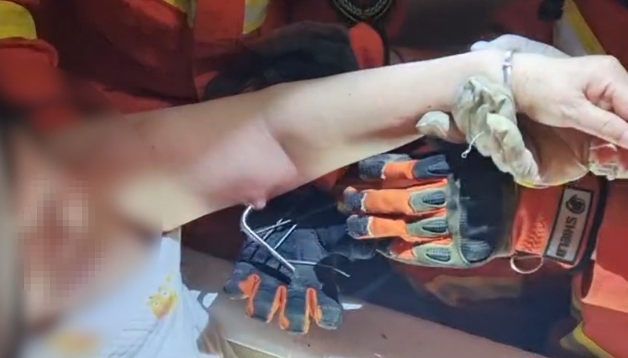 浴室置物架铁丝狠狠刺入老人手臂!家中有这类设施的请定期检查 浴室置物架铁丝狠狠刺入老人手臂!家中有这类设施的请定期检查