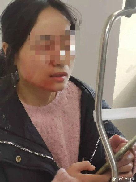 校方通报教师被学生用镊子戳伤眼球 校方通报教师被学生用镊子戳伤眼球