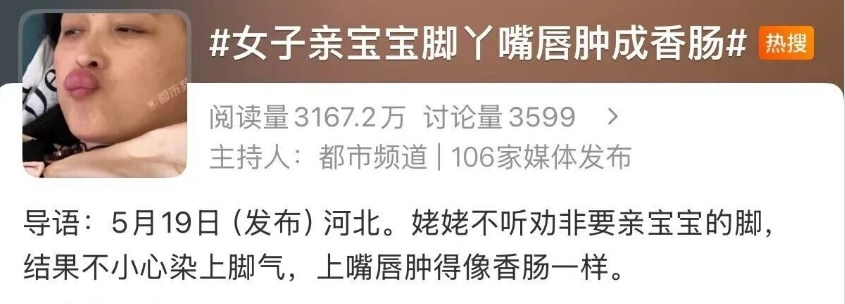 姥姥亲吻婴儿脚丫,嘴唇红肿如香肠,医生:婴儿脚部同样存有大量微生物 姥姥亲吻婴儿脚丫,嘴唇红肿如香肠,医生:婴儿脚部同样存有大量微生物
