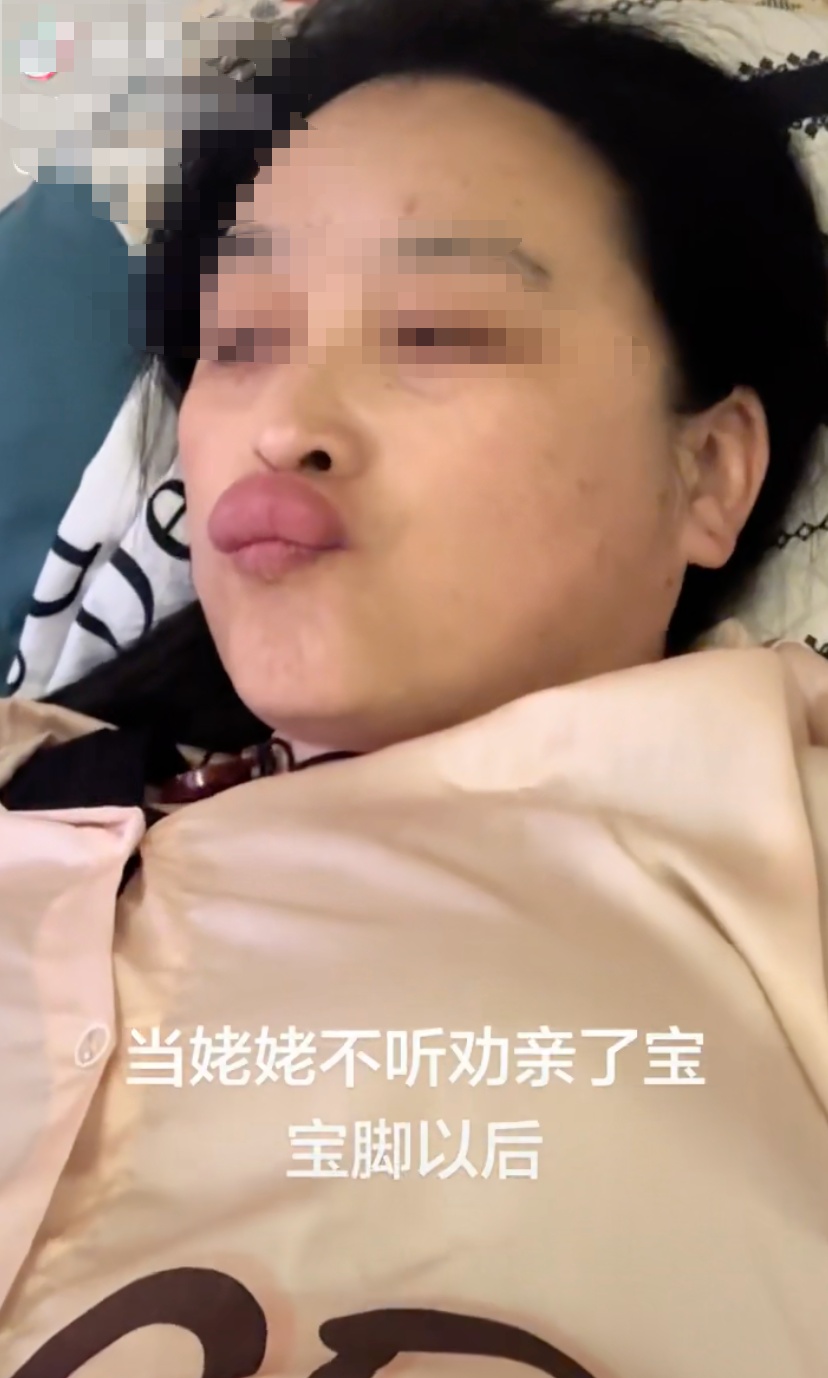 姥姥不听劝亲吻婴儿脚丫，结果不小心染上脚气，嘴唇红肿如香肠！医生提醒→