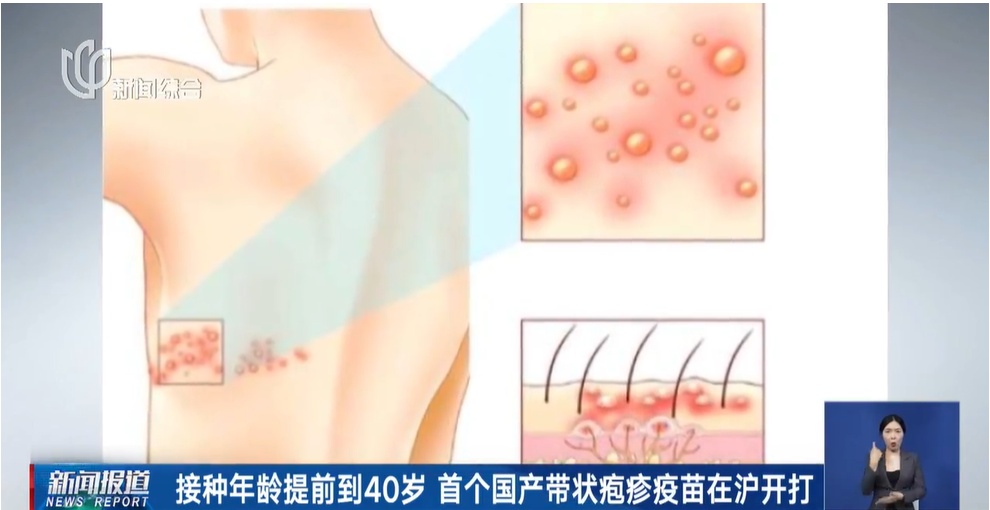 男子自制“衣物隔离架”绑身上！医生：很机智又很心疼…