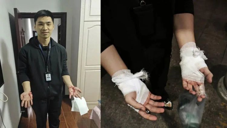 “幸好没扎脸上，不然婚都结不了了……”