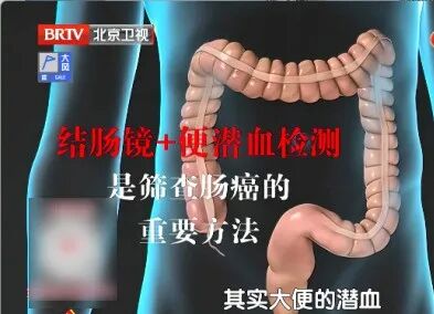 这种大便,真的很危险,出现3个变化,小心癌症找上门,抓紧去医院 这种大便,真的很危险,出现3个变化,小心癌症找上门,抓紧去医院
