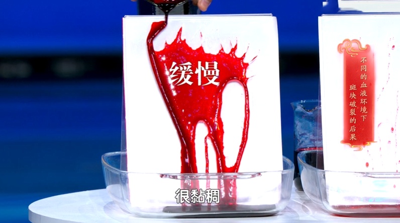 马上停止5类运动,很可能加速血栓形成,等血管“堵死”就迟了 马上停止5类运动,很可能加速血栓形成,等血管“堵死”就迟了