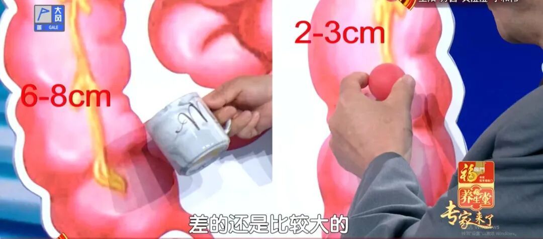 这种大便,真的很危险,出现3个变化,小心癌症找上门,抓紧去医院 这种大便,真的很危险,出现3个变化,小心癌症找上门,抓紧去医院