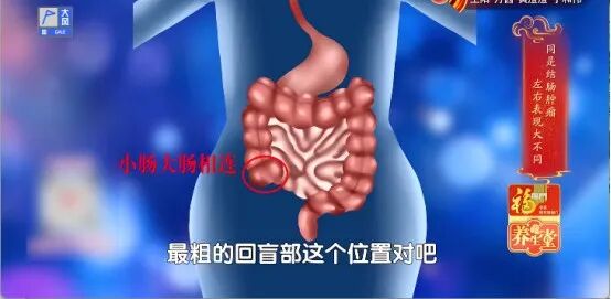 这种大便,真的很危险,出现3个变化,小心癌症找上门,抓紧去医院 这种大便,真的很危险,出现3个变化,小心癌症找上门,抓紧去医院