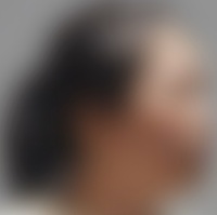 4人在深圳南山一餐馆吃饭，卡式炉突然爆炸！当心这个“餐桌炸弹”