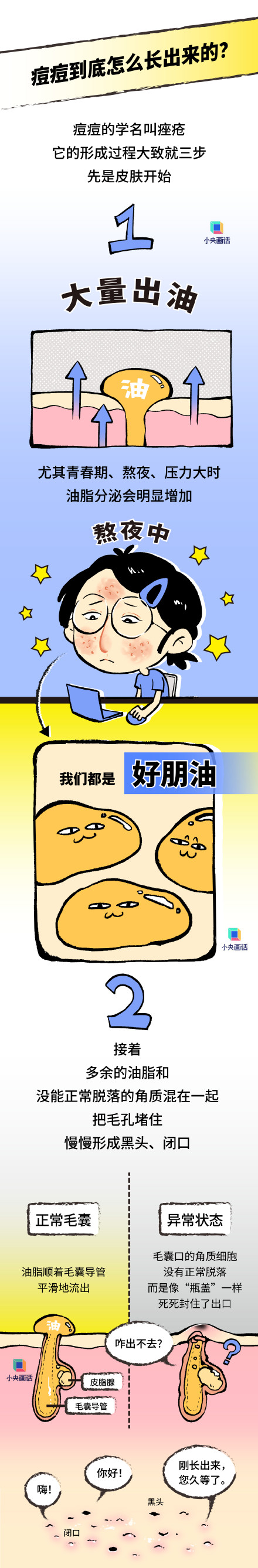 为啥全身上下脸最爱长痘