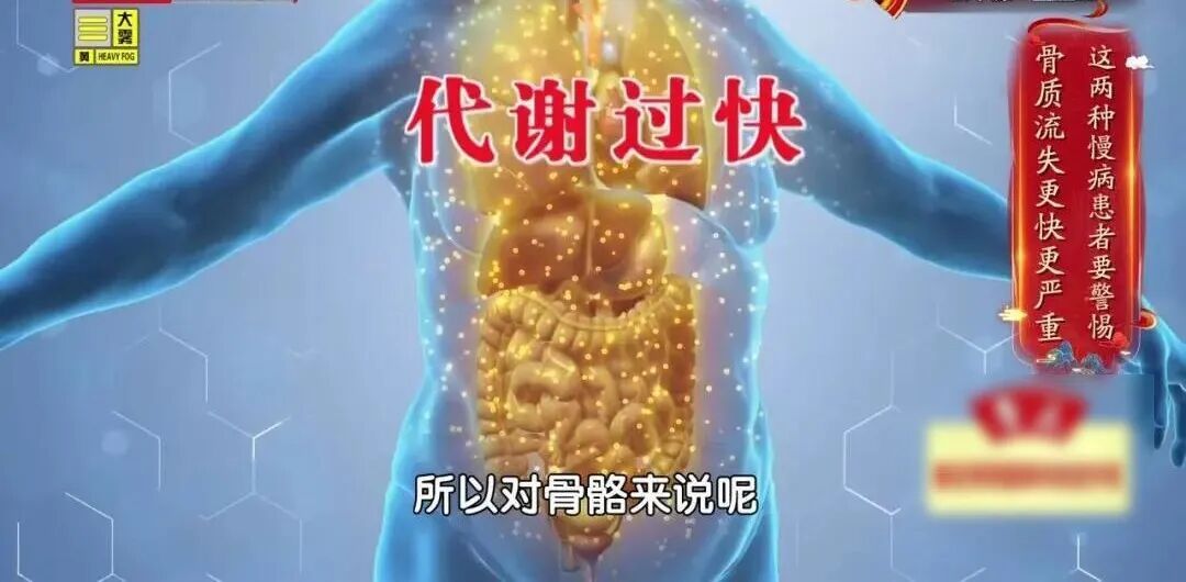 骨质疏松“偏爱”这2类人，认准一个“黄金三角”组合，把钙补到骨头里