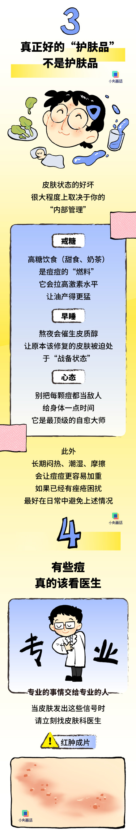 为啥全身上下脸最爱长痘