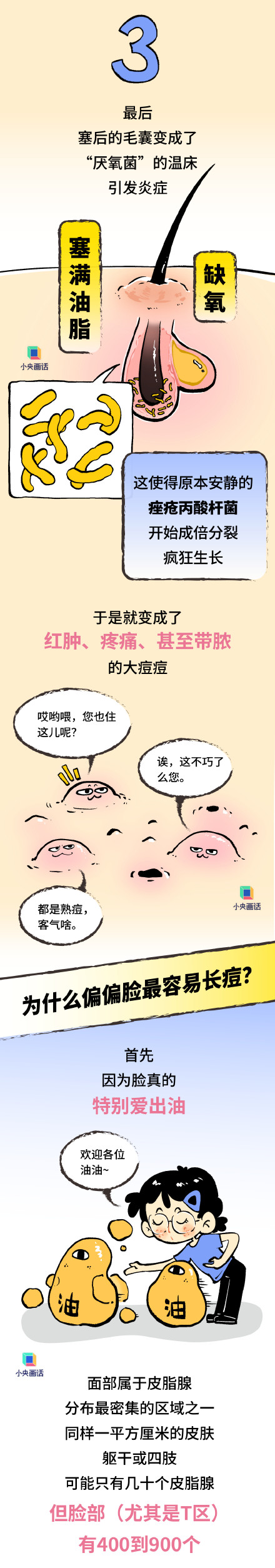 为啥全身上下脸最爱长痘