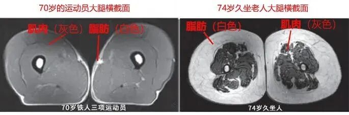 运动是加速衰老，还是延缓衰老？真相揭开：我们被骗了好多年