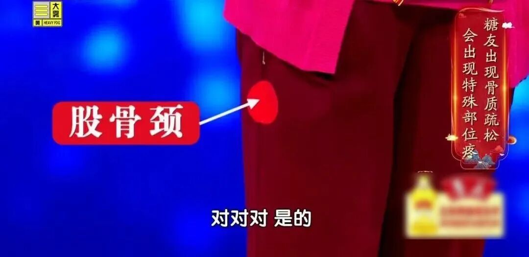 骨质疏松“偏爱”这2类人，认准一个“黄金三角”组合，把钙补到骨头里