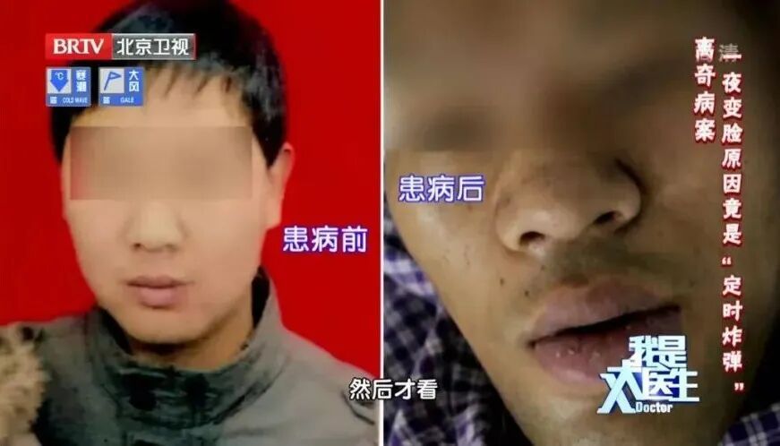 陪妈妈看病,被一眼看出有肿瘤,原来这几种疾病都写在脸上 陪妈妈看病,被一眼看出有肿瘤,原来这几种疾病都写在脸上