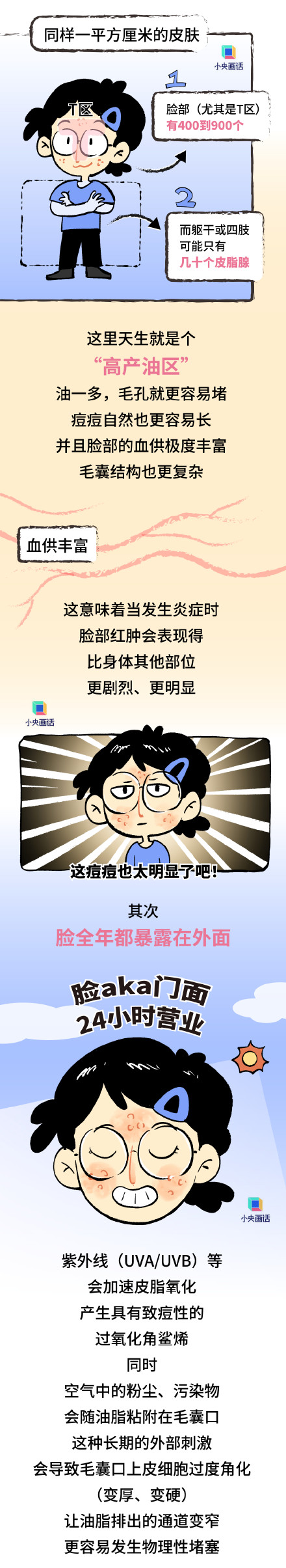 为啥全身上下脸最爱长痘