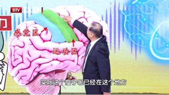 陪妈妈看病,被一眼看出有肿瘤,原来这几种疾病都写在脸上 陪妈妈看病,被一眼看出有肿瘤,原来这几种疾病都写在脸上