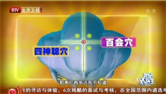 看头发,就知道你身体好不好!脾胃差的,头发或有这些特征 看头发,就知道你身体好不好!脾胃差的,头发或有这些特征